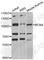 DNA replication licensing factor MCM4 antibody, A3018, ABclonal Technology, Western Blot image 