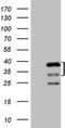 Protein Kinase AMP-Activated Non-Catalytic Subunit Beta 2 antibody, NBP2-45389, Novus Biologicals, Western Blot image 