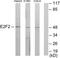 E2F Transcription Factor 2 antibody, TA311688, Origene, Western Blot image 