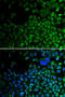 Histone Deacetylase 2 antibody, 18-488, ProSci, Immunofluorescence image 