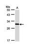 FRAT Regulator Of WNT Signaling Pathway 1 antibody, NBP1-31213, Novus Biologicals, Western Blot image 