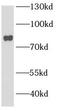 Bardet-Biedl syndrome 2 protein antibody, FNab00815, FineTest, Western Blot image 
