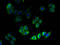3-hydroxy-3-methylglutaryl-coenzyme A reductase antibody, A52932-100, Epigentek, Immunofluorescence image 