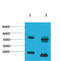 Potassium Voltage-Gated Channel Subfamily A Member 10 antibody, STJ97593, St John