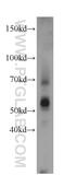 SAMM50 Sorting And Assembly Machinery Component antibody, 20824-1-AP, Proteintech Group, Western Blot image 