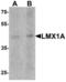 LIM Homeobox Transcription Factor 1 Alpha antibody, LS-B8881, Lifespan Biosciences, Western Blot image 