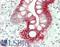 Keratin 20 antibody, LS-B14506, Lifespan Biosciences, Immunohistochemistry paraffin image 