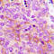 Protein Kinase AMP-Activated Non-Catalytic Subunit Gamma 2 antibody, LS-C358248, Lifespan Biosciences, Immunohistochemistry paraffin image 