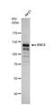 Desmocollin 2 antibody, NBP1-32961, Novus Biologicals, Western Blot image 