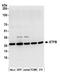 Electron transfer flavoprotein subunit beta antibody, A305-484A, Bethyl Labs, Western Blot image 