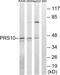 Proteasome 26S Subunit, ATPase 6 antibody, abx014068, Abbexa, Western Blot image 