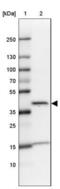 Trans-L-3-Hydroxyproline Dehydratase antibody, NBP2-31648, Novus Biologicals, Western Blot image 