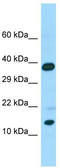 Calmodulin Like 6 antibody, TA331664, Origene, Western Blot image 