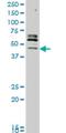 Serine/Threonine Kinase 32C antibody, H00282974-M05, Novus Biologicals, Western Blot image 