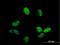 Zinc Finger CCCH-Type Containing 14 antibody, H00079882-B01P, Novus Biologicals, Immunofluorescence image 