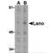 Leucine Rich Repeat Containing 1 antibody, MBS150699, MyBioSource, Western Blot image 