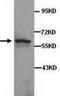 Decapping MRNA 1A antibody, TA310147, Origene, Western Blot image 