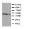 C-C Motif Chemokine Receptor 4 antibody, orb47984, Biorbyt, Western Blot image 