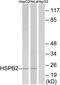 Heat shock protein beta-2 antibody, TA313167, Origene, Western Blot image 
