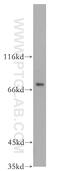 Forkhead box protein O6 antibody, 19122-1-AP, Proteintech Group, Western Blot image 