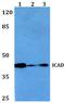 DNA Fragmentation Factor Subunit Alpha antibody, A03671-3, Boster Biological Technology, Western Blot image 