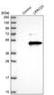 Leucine Rich Repeat Containing 23 antibody, PA5-58095, Invitrogen Antibodies, Western Blot image 
