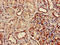 Dolichyl-Phosphate Mannosyltransferase Subunit 1, Catalytic antibody, CSB-PA007134LA01HU, Cusabio, Immunohistochemistry paraffin image 