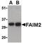 Fas apoptotic inhibitory molecule 2 antibody, PA5-20311, Invitrogen Antibodies, Western Blot image 