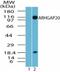 Rho GTPase Activating Protein 20 antibody, NBP2-24757, Novus Biologicals, Western Blot image 