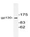 Interleukin 6 Signal Transducer antibody, AP06506PU-N, Origene, Western Blot image 