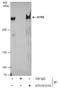 ATRX Chromatin Remodeler antibody, GTX101310, GeneTex, Immunoprecipitation image 