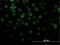 Cyclin D Binding Myb Like Transcription Factor 1 antibody, H00009988-M03, Novus Biologicals, Immunofluorescence image 
