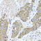 Peroxisomal membrane protein PEX14 antibody, LS-C349063, Lifespan Biosciences, Immunohistochemistry paraffin image 