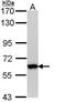 SARS antibody, PA5-29761, Invitrogen Antibodies, Western Blot image 
