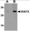 VENT Homeobox antibody, orb94563, Biorbyt, Western Blot image 