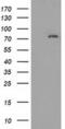 Myotubularin Related Protein 14 antibody, MA5-25219, Invitrogen Antibodies, Western Blot image 