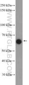 Zinc Finger Protein Interacting With K Protein 1 antibody, 21934-1-AP, Proteintech Group, Western Blot image 