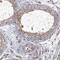 Leucine Rich Repeat Containing 28 antibody, NBP2-48706, Novus Biologicals, Immunohistochemistry paraffin image 