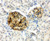 NPHS2 Stomatin Family Member, Podocin antibody, PA1322, Boster Biological Technology, Immunohistochemistry paraffin image 