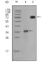 Ret Proto-Oncogene antibody, abx012225, Abbexa, Enzyme Linked Immunosorbent Assay image 