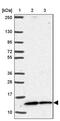 Phospholipase A And Acyltransferase 2 antibody, PA5-63640, Invitrogen Antibodies, Western Blot image 