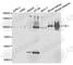 Villin 1 antibody, A5494, ABclonal Technology, Western Blot image 