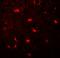 Microtubule-associated proteins 1A/1B light chain 3C antibody, LS-B10166, Lifespan Biosciences, Immunofluorescence image 