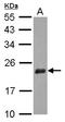 Nudix Hydrolase 3 antibody, LS-C155431, Lifespan Biosciences, Western Blot image 