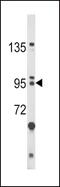 Protein bicaudal C homolog 1 antibody, MBS9204871, MyBioSource, Western Blot image 