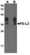 Programmed cell death 1 ligand 2 antibody, TA355065, Origene, Western Blot image 