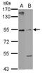 Armadillo Repeat Containing 3 antibody, LS-C155747, Lifespan Biosciences, Western Blot image 