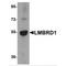 Probable lysosomal cobalamin transporter antibody, MBS150185, MyBioSource, Western Blot image 