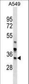 Armadillo Repeat Containing 1 antibody, LS-C159119, Lifespan Biosciences, Western Blot image 