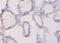 Plexin A1 antibody, A52556-100, Epigentek, Immunohistochemistry paraffin image 